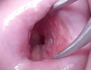 Japanese Wife Open Cervix Wide to watch medial Uterus