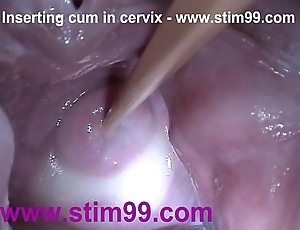 Insertion semen cum surrounding cervix alongside distension pussy reflector